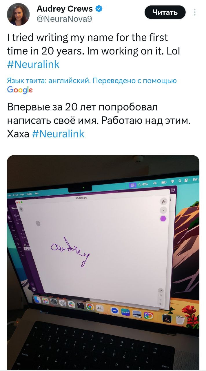 Илон Маск придумал телепатию — парализованная девушка научилась рисовать и писать силой мысли