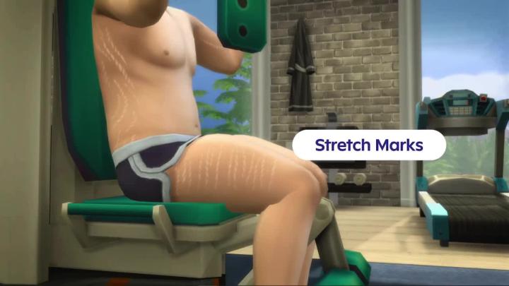 Новости из дурки: вместе с новым DLC в Sims 4 добавили растяжки и кожное заболевание